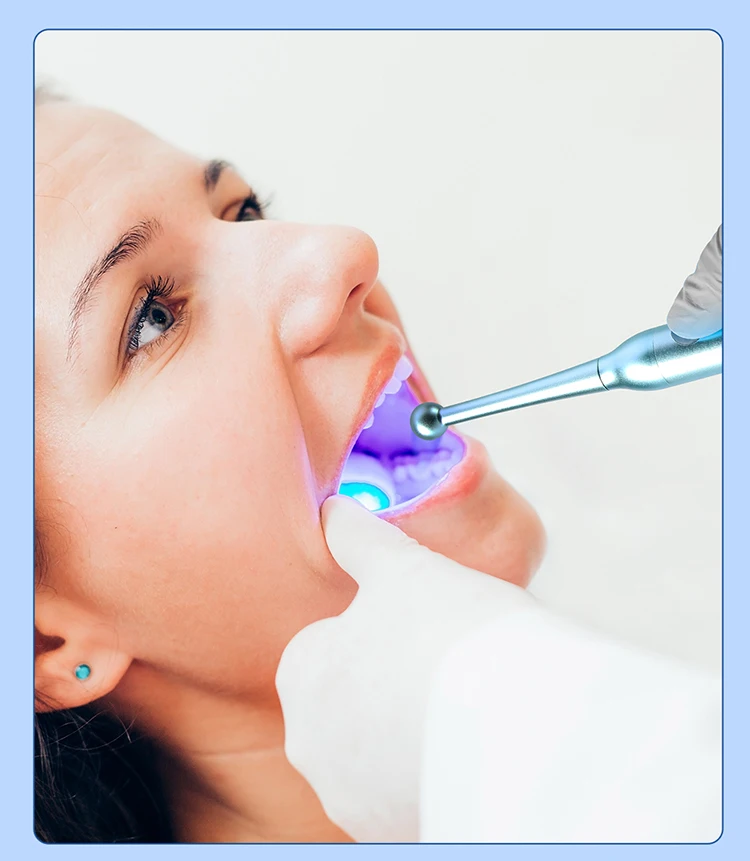 AZDENT Dental LED-Härtungslampe, kabellose Heilungslampe, Lichtintensität 800–2300 mW/cm2, 1 Sekunde Aushärtung, 10 W, Hochleistungs-Zahnmedizinwerkzeug – Detail 6