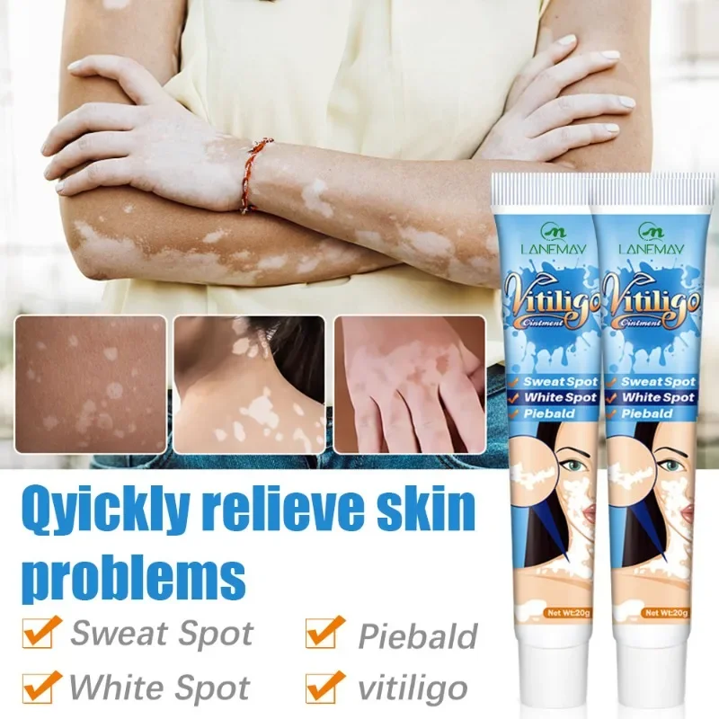 

White Spot Removal Ointment Tinea Versicolor Care Cream External Use for Skin Pigmentation Issues