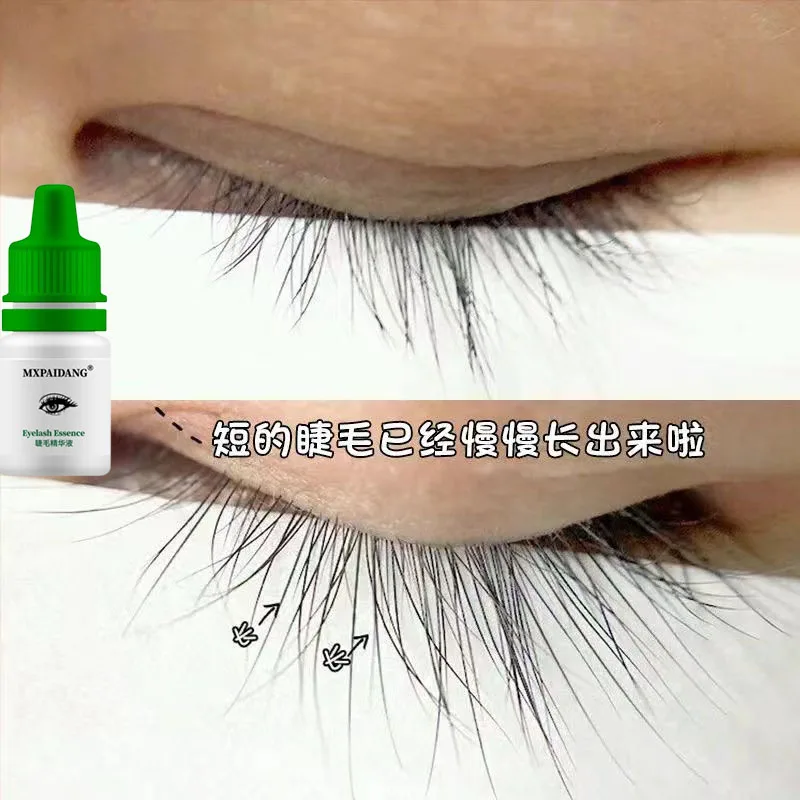 Snelle wenkbrauwgroei-essentie, wimper- en haargroei-anti-haaruitvalproduct, voorkom kaalheid, verdikt, verdicht en verlengen, e