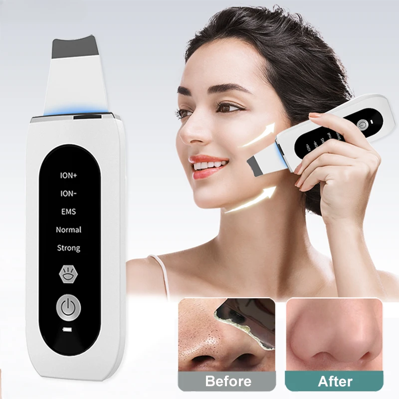 

Ultrasonic Skin Scrubber Peeling Blackhead Remover Deep Face Cleaning Ultrasonic Ion Ance Pore Cleaner Facial Shovel Cleanser