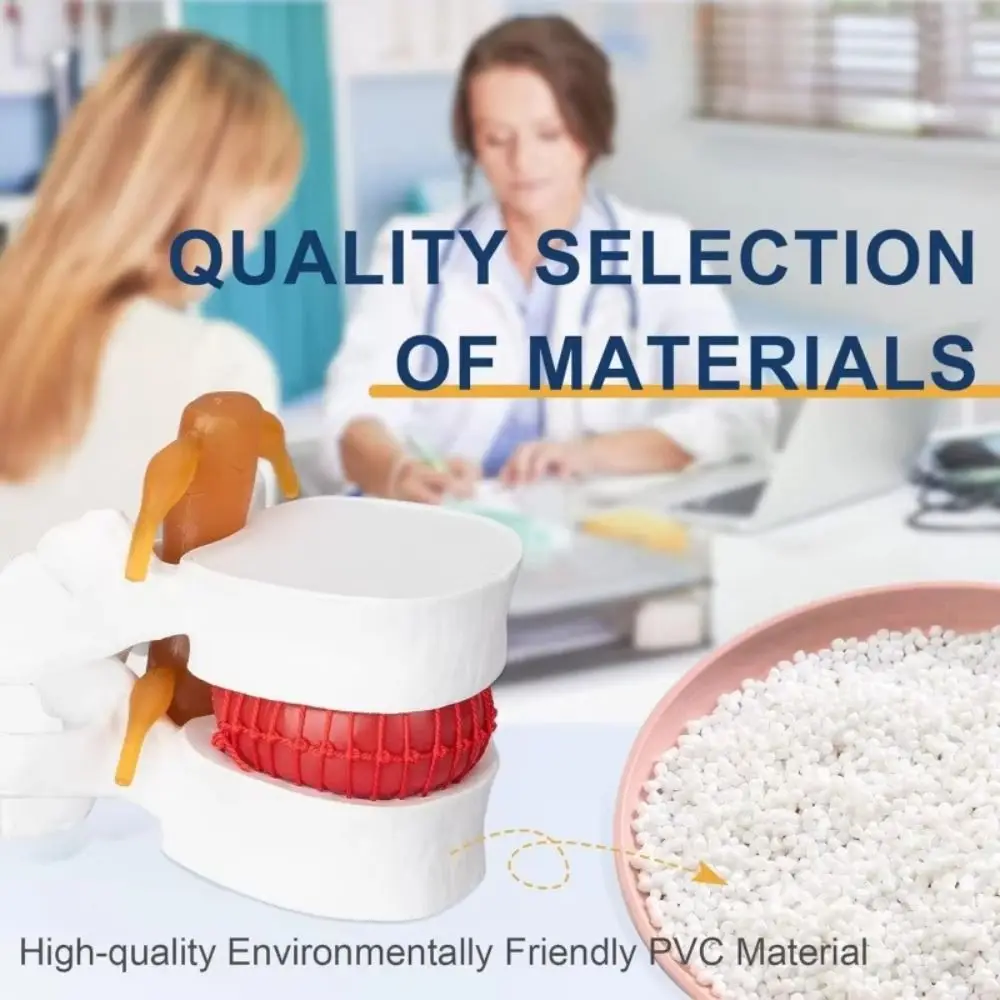 

3D-модель поясничного отдела позвоночника: демонстрация компрессии, увеличенная в 1,5 раза, для изучения грыжи межпозвоночного диска, учебное и симуляционное пособие