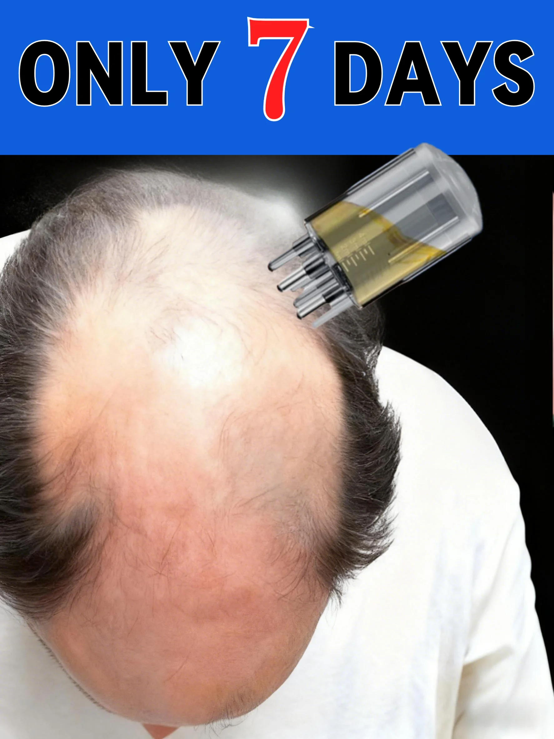 

Сыворотка для роста волос, масляная комбинация, аппликатор для кожи головы, жидкая расческа для лечения кожи головы, устройство для сторонних волос