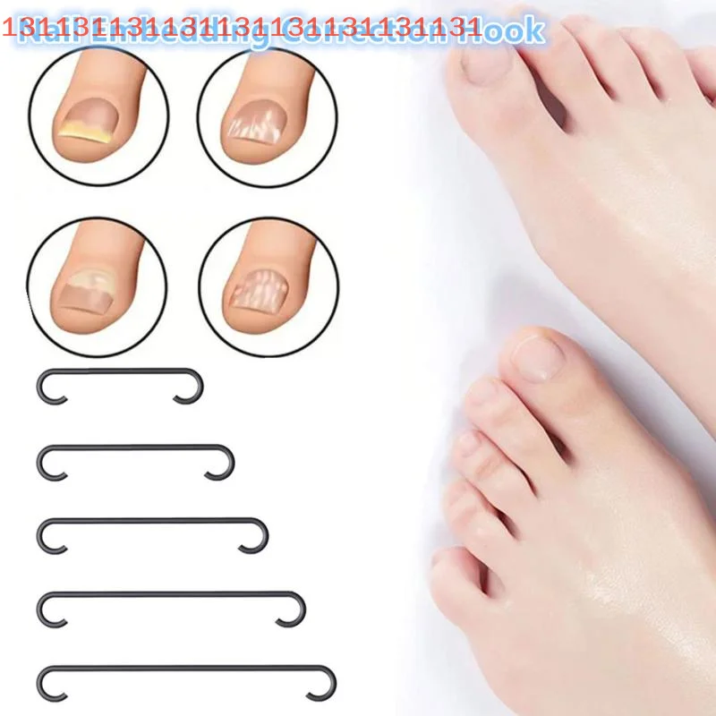 أدوات مصحح أظافر نام باديكير استعادة تضمين تو مسمار المهنية نام أظافر استقامة كليب هدفين #2