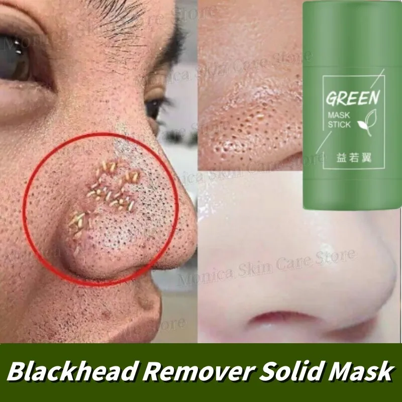 Original grüner Tee tief entfernen Mitesser Akne Schlamm Maske Stick Schrumpfen Poren zerstreuen Akne Creme behandeln Pickel koreanische saubere Hautpflege