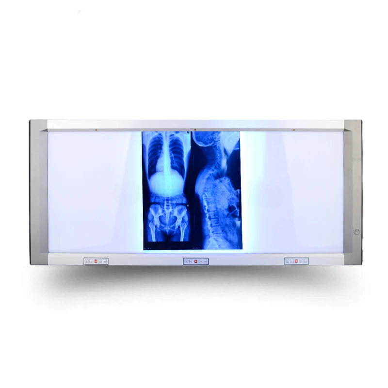 Triple Panel X Ray Traditional Heat source Medical Film Viewer Light Box