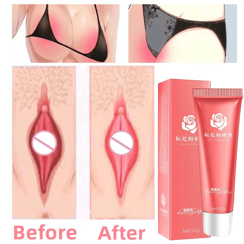 Sexy Women Vaginal Lips Private Part Pink Underarm Intimate Whitening Dark Nipple Anal Bleaching Cream Skin Care Body Cream