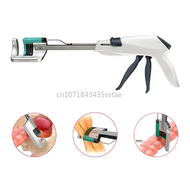 DST Series Stapler Disposable Curved Cutter Stapler For Minimally Invasive Surgery