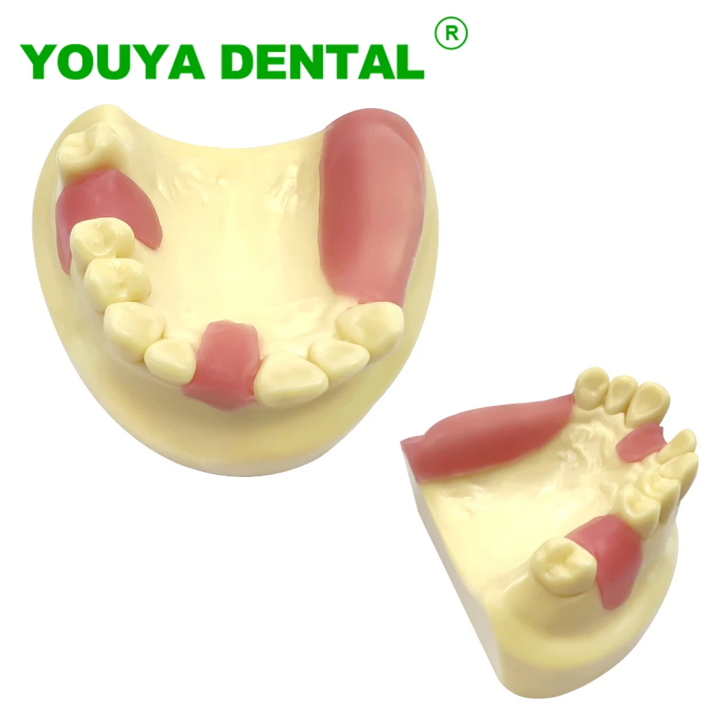 

Dental Implant Model Practice Jaw Teaching Typodont Model Dentist Educational Student Teeth Training Model Dentistry Products