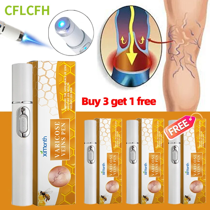 

4pcs Leg Repair Laser Pen Improve Blood Circulation Relief Medicine Vasculitis Phlebitis Removal Varicose Veins