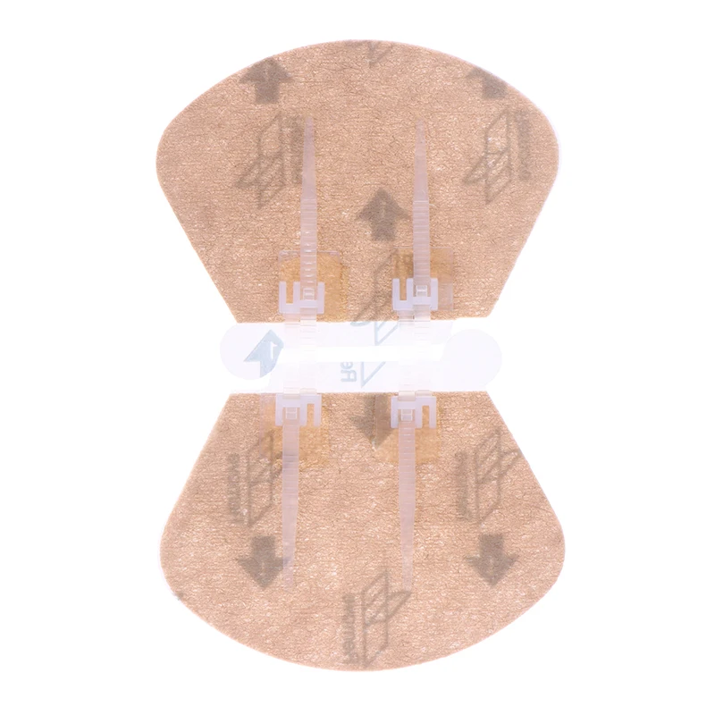 2 pezzi cerniera cravatta chiusura della ferita cerotto cerniera cerotto ferita sutura veloce cerotti emostatici portatili all'aperto strumento di primo soccorso