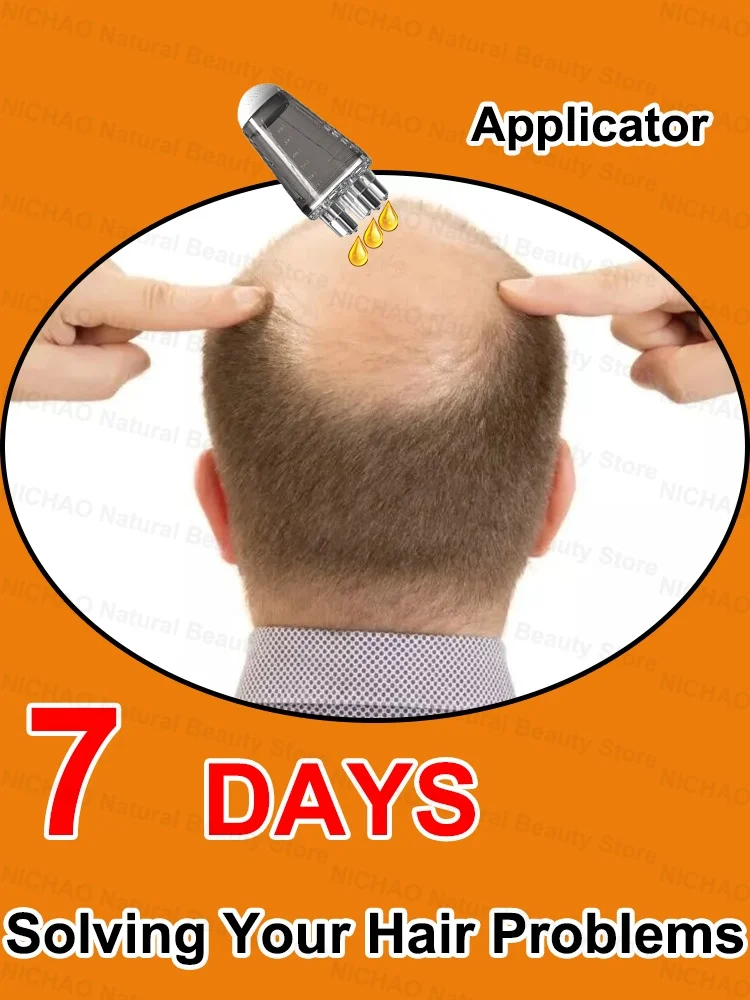 

Improve your hair thinning problem