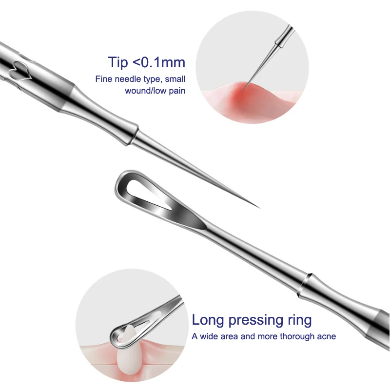 Comedondrukker Puistje Popper Tool Acne Naald Verwijderen Behandeling Whitehead Popping Zit Neus Gezicht Smet Extractor Cleanser