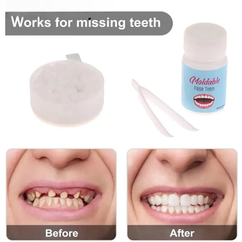 Resina 10g/15g/20g Denti E Lacune FalseTeeth Colla Solido Kit di Riparazione Temporanea Dei Denti Protesi Adesivo Sbiancamento Dei Denti bellezza dei denti