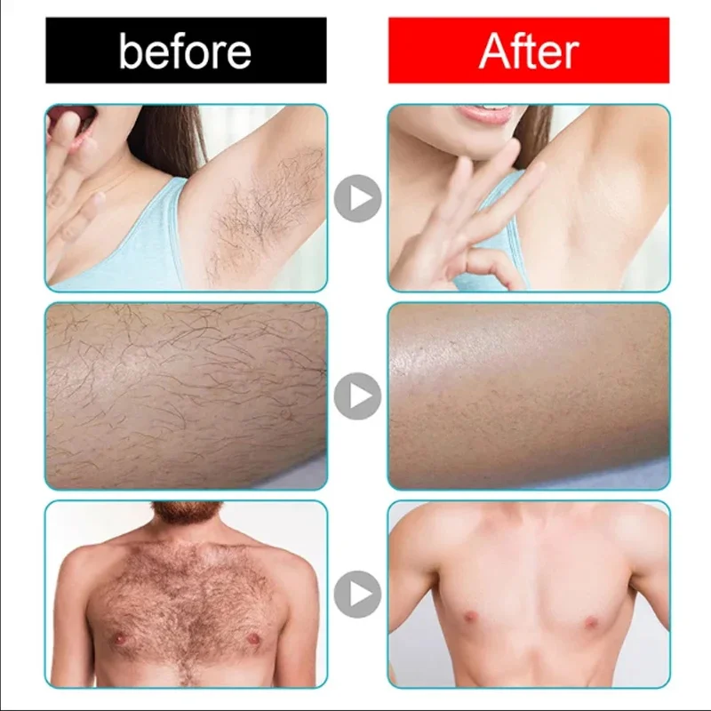 Permanent Hair Removal Spray Fast Hair Growth Inhibition Remove Armpit Legs Arms Painless Depilatory Nourishing Repair Body Care