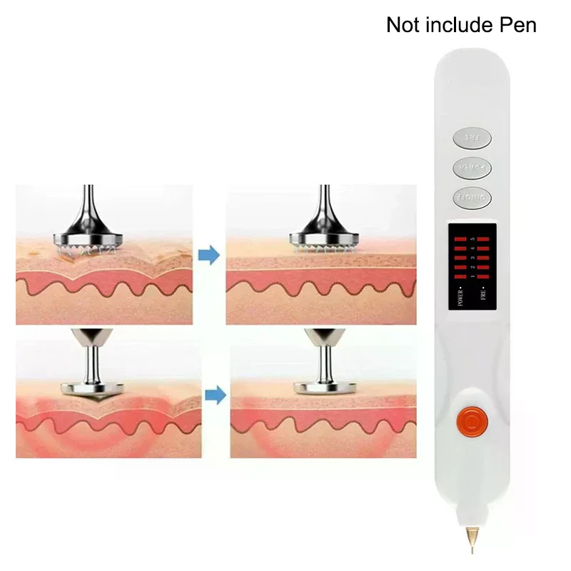 1-2-6-шт-компл-игла-для-удаления-веснушек-игла-для-удаления-бородавок-игла-для-удаления-родинок-игла-для-удаления-веснушек-сменная-темная-плазменная-ручка-для-веснушек