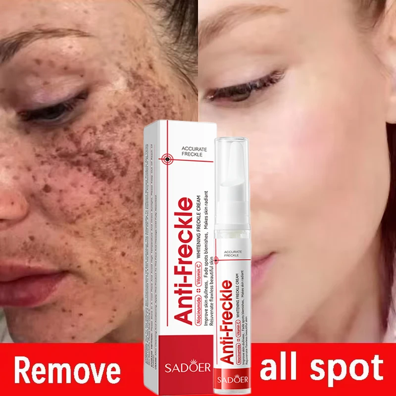 

Effective Whitening Freckles Face Cream Removal Melasma Dark Spots Fade Melanin Pigmentation Corrector Brighten Repair Skin Care