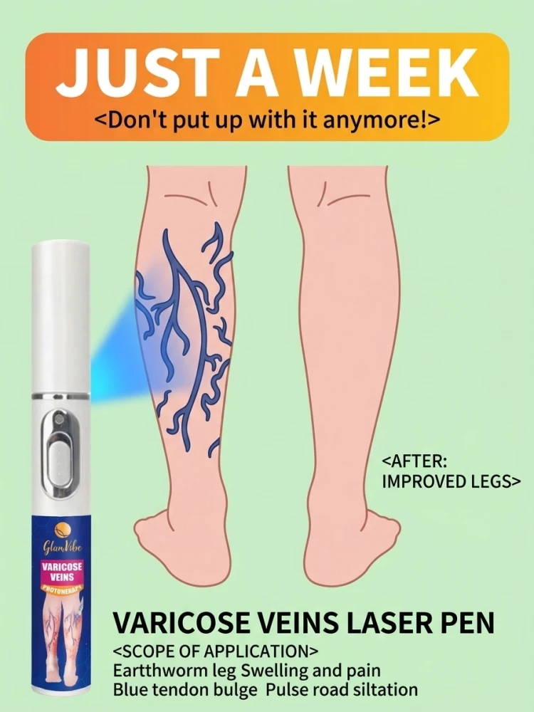 

Leg swelling and bulging veins from prolonged sitting can be relieved by laser treatment.