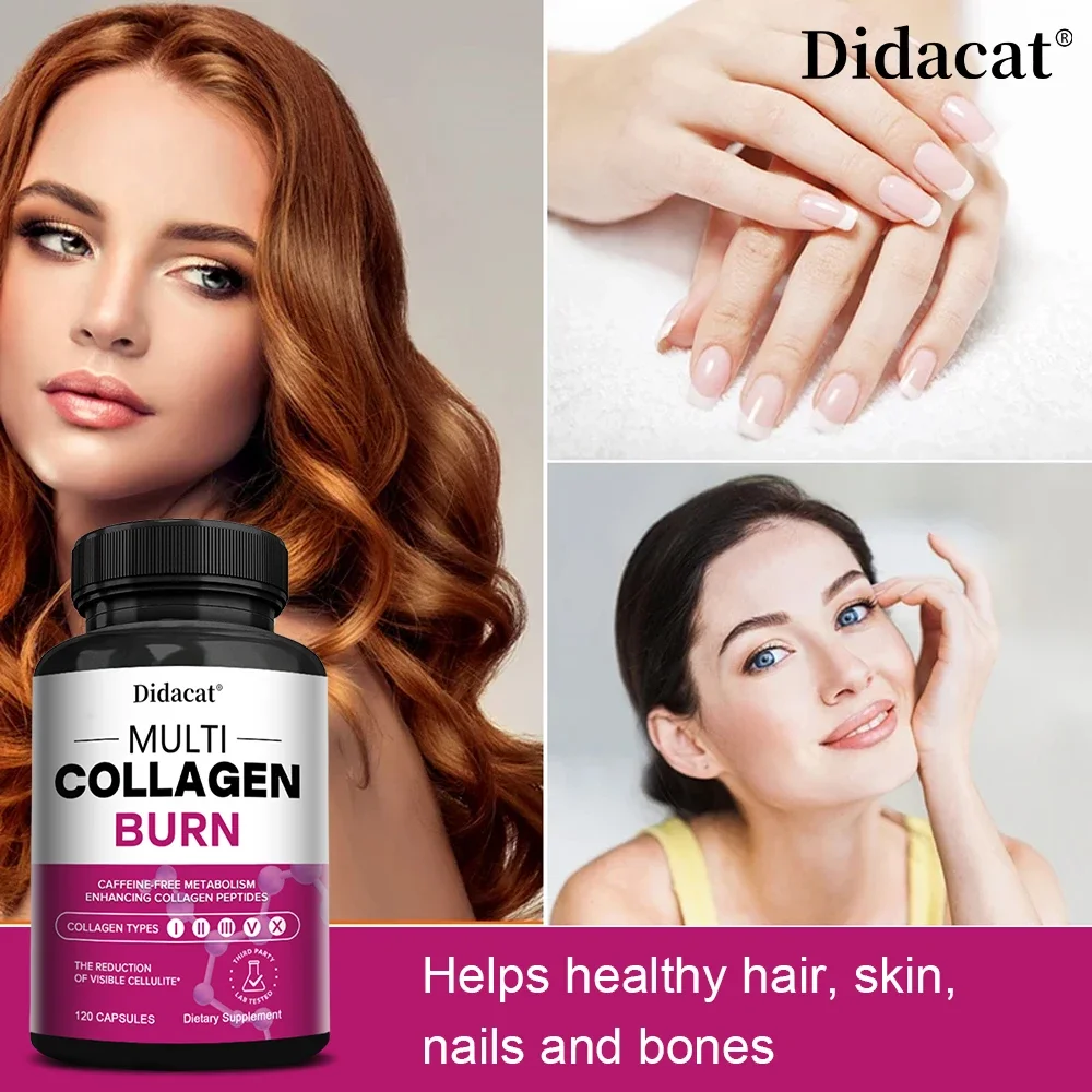 Multi-Collagen Burn - Helps Boost Metabolism, Burn Fat, Support Healthy Hair, Nails, Skin, Teeth and Gums - Collagen Peptides