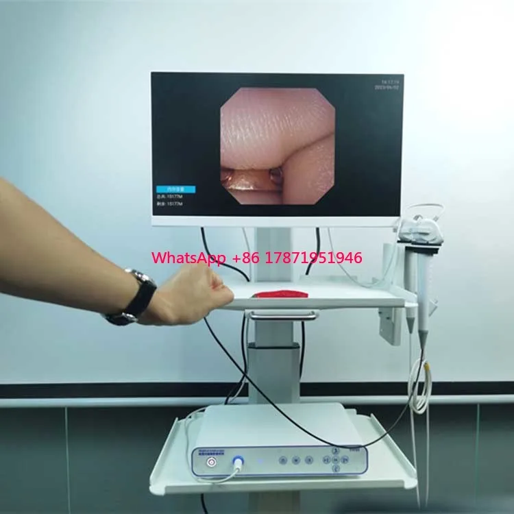 

2024 new disposable flexible ureteroscope portable HD endoscope image processor