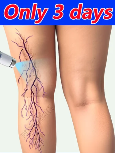 Bolígrafo de luz azul, más descuentos, 2025, cuidado corporal.