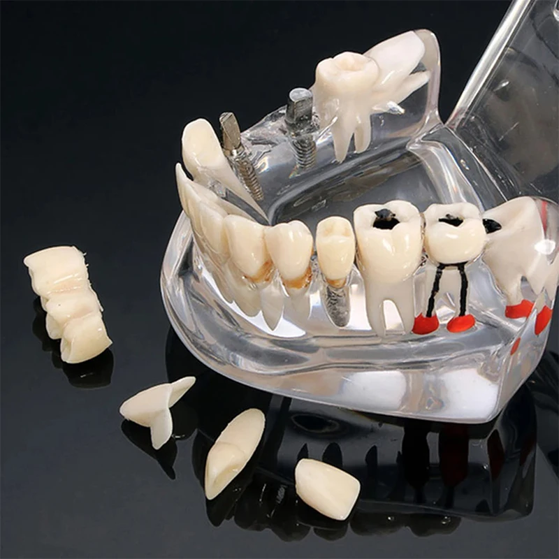 Thumbnail 3 - #23 Ranked Dental Teaching Models Picks in 2026