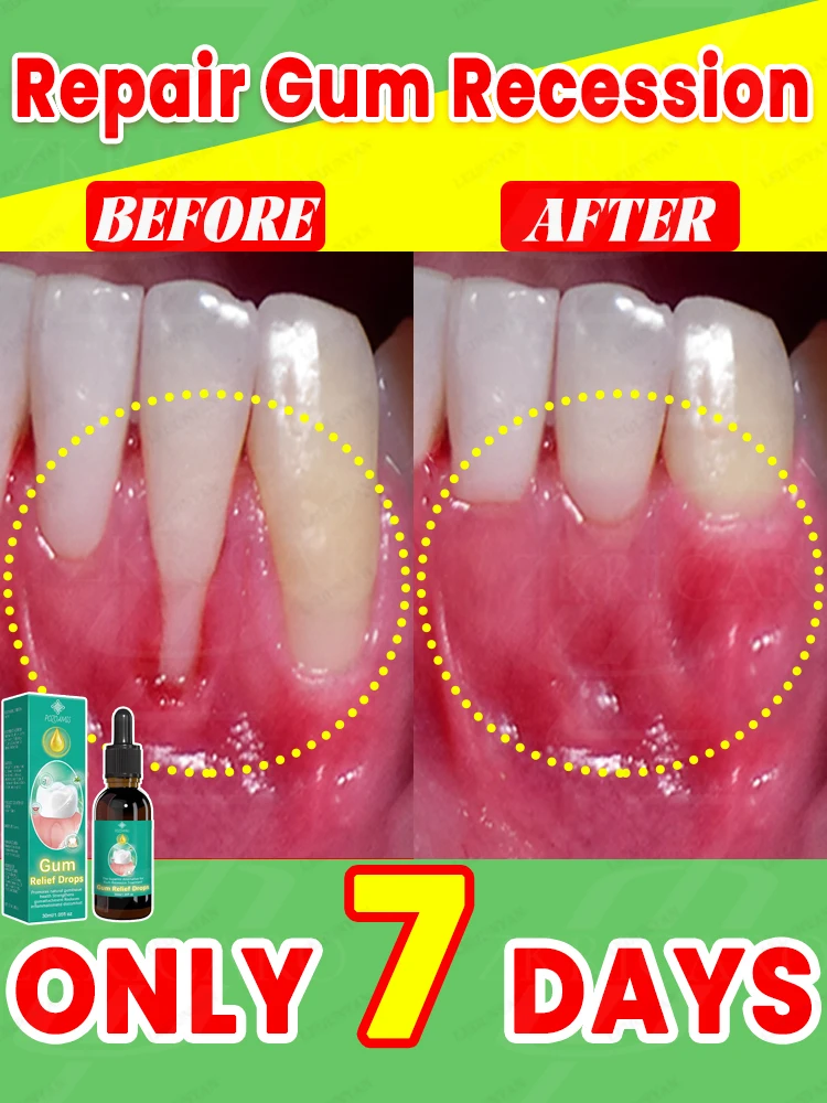 Repair damaged gums, relieve gum pain, strengthen gums, and restore healthy gums