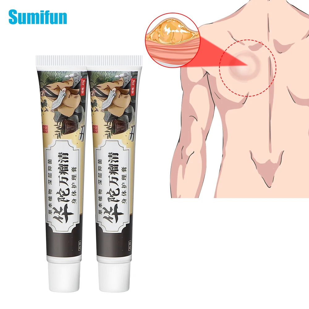 20g Chinese Huatuo Lipoma Removal Cream Remove Fat Lump Skin Nodular Antibacterial Ointment Anti-Tumor Detox Medical Plaster