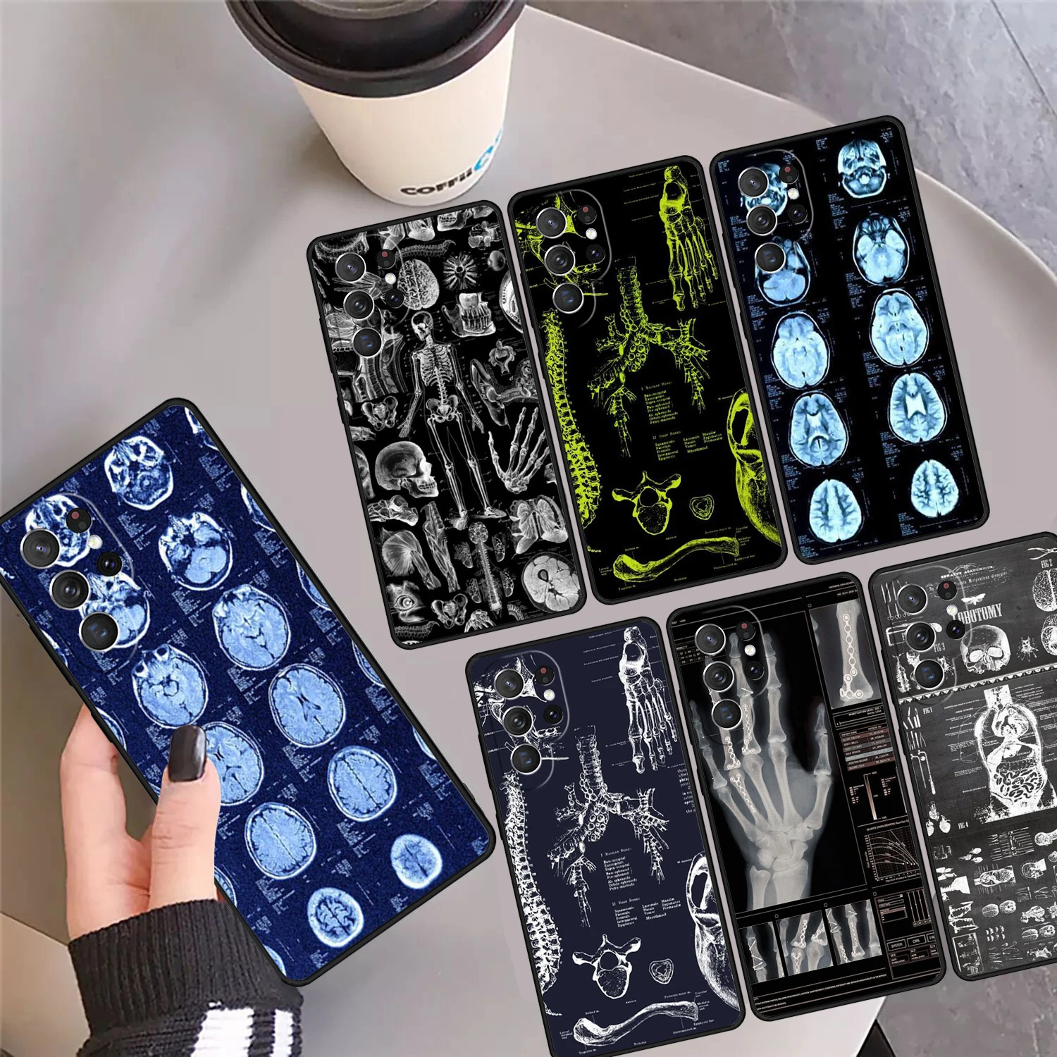 

Чехол для телефона Radiological Human Organs Skeleton для Samsung Galaxy S24 S25 Ultra S23 S22 Plus S21 FE S20 Note 10 20 Pro