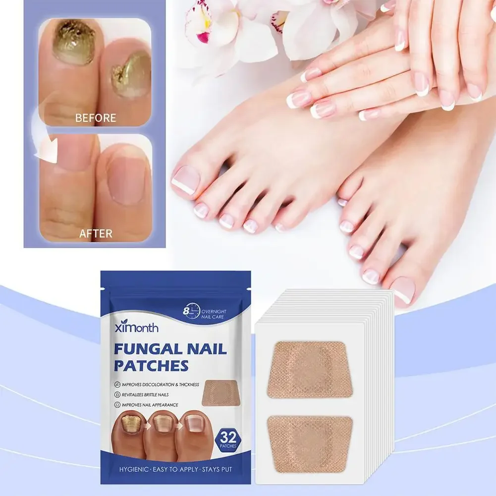 32 Pcs Paronychia Treatment Patch Fungus Removal Nail Correction Stickers Ingrown Nails Recover Pedicure Tools Repair Patches