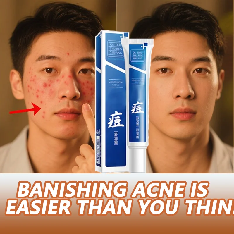 

Anti-Acne Pore Shrinking Cream Blackehead Acne Treatment Clear Skin Brighten Whiten Moisturize Eliminate acne skin care Soothes