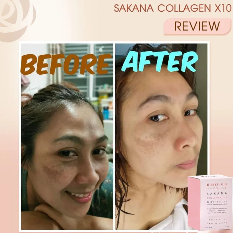 Premium Collagen X10 Sakana Rosegold Heathy Skin Anti Aging Acne Melanin Freckles Whitening Brighten Moisture Smooth Skin