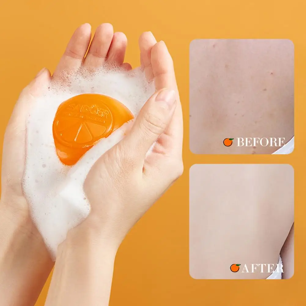 Vitamin C Skin Whitening Soap Melanin Removal For Private Area Underarm Bikini Dark Spot Remover Face Body Wash Cleansing Bar