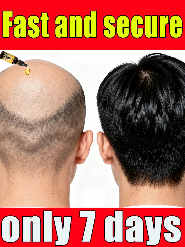 Do you want to say goodbye to hair loss? Our products can penetrate the hair follicles and help your hair regenerate