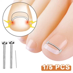 Ingrown Toenail Corrector Tools Pedicure Recover Embed Toe Nail Treatment Professional Ingrown Toenail Straightening Clip Tool