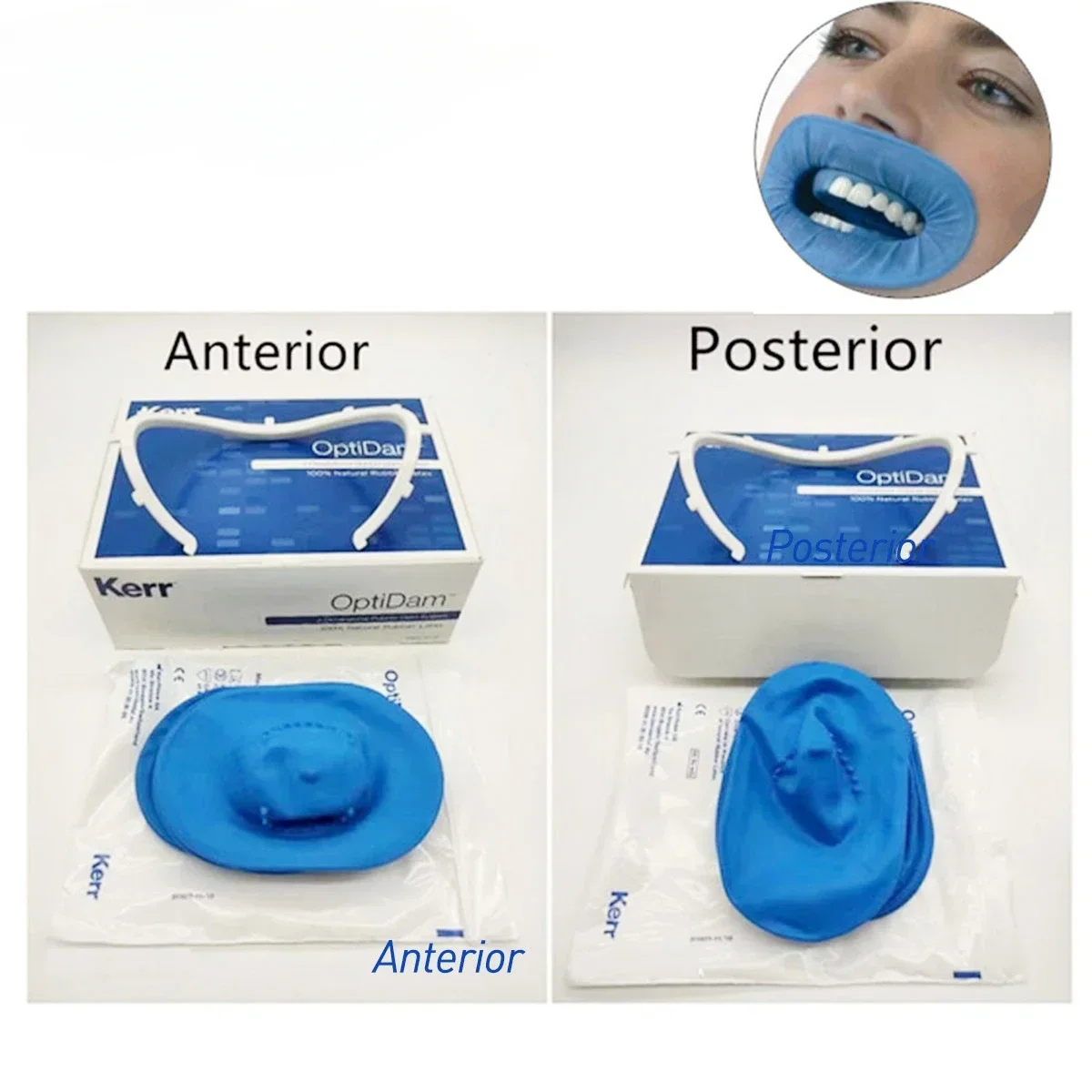 Comprehensive Dental Kit:Kerr Optidam Posterior Intro Kit 3D Nipple Rubber Dam Sheets, OptiDam Clip Clamps, Anterior & Posterior