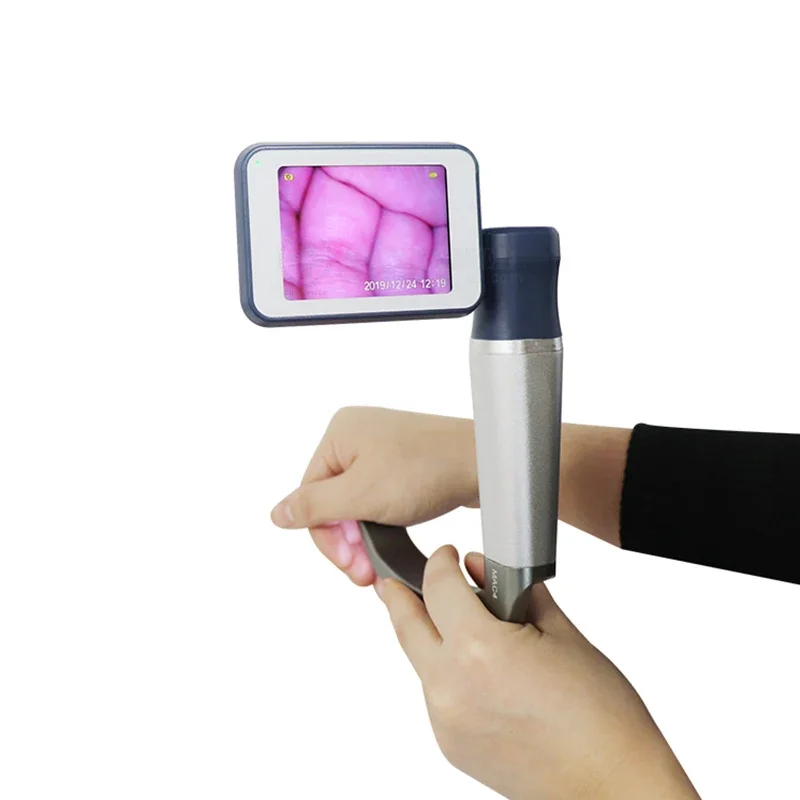 SY-P020N Endoscopic HD   Assist Rigid Video Laryngoscope/ENT Endoscope  for Cheap Laryngoscope