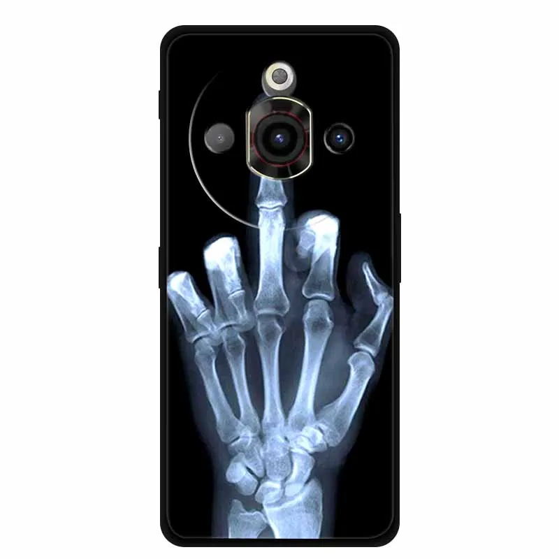 For ZTE NUBIA FOCUS PRO 5G Case Animals Soft Silicone TPU Phone Cases Back Cover for Z2351N 6.72\