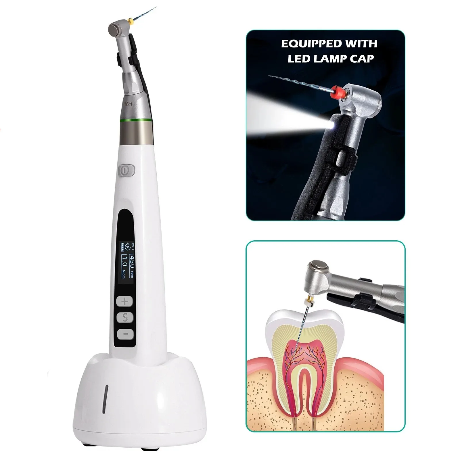 

Dental Wireless LED Endo Motor 16:1 Reciprocating Root Canal Treatment 9 Modes