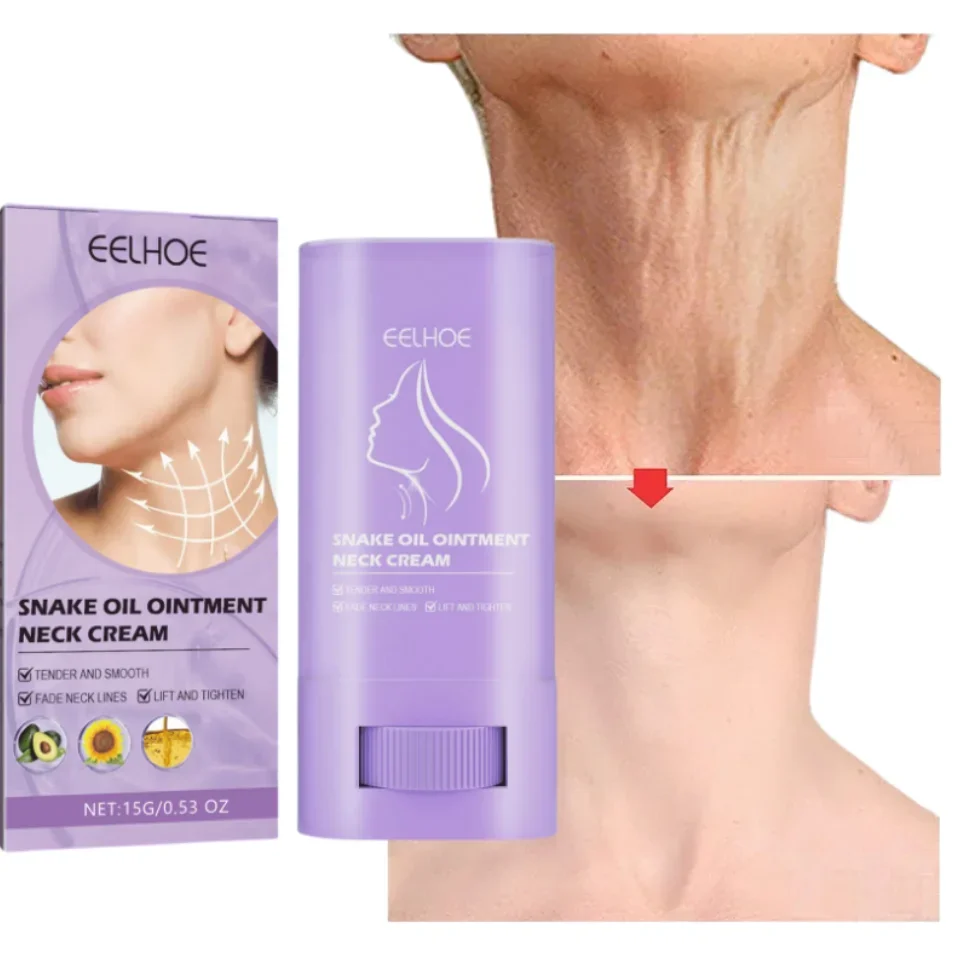 Neck Lines Cream Moisturis Lift Neck Eliminate Double Chin Eliminate Neck Fine Lines Anti-ageing Brightening Moisturizer