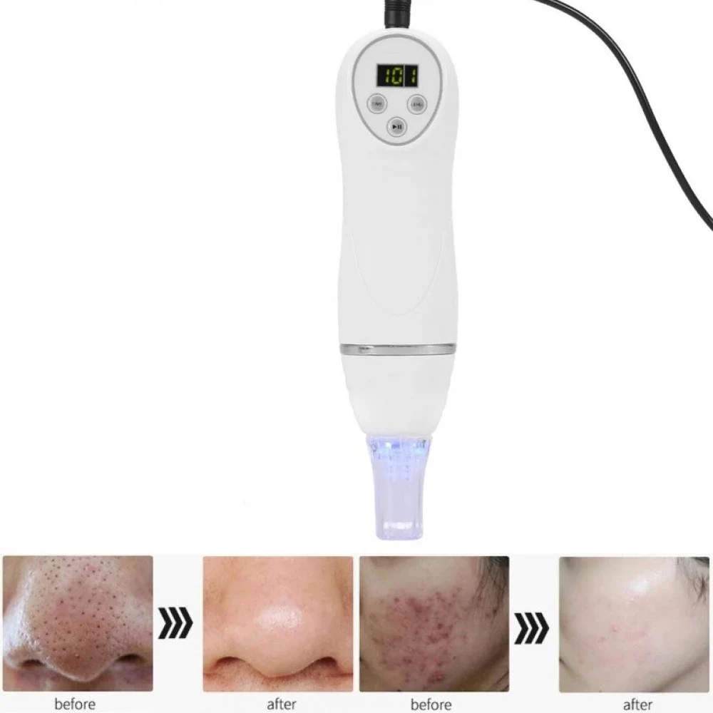 Digital Microdermabrasion Diamond Dermabrasion Pen Vacuum Massage Skin Peeling Acne Treatment Blackhead Removal Cleanser Tool
