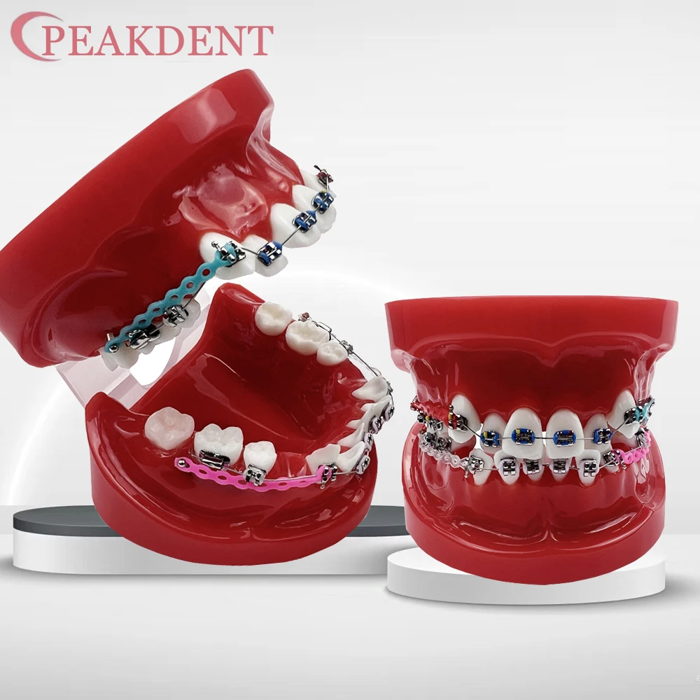 

Dental Model with Orthodontic Bracket Chain Ties Arch Wire Dental Teaching Model For Dentist Treatment Demo Training Studying