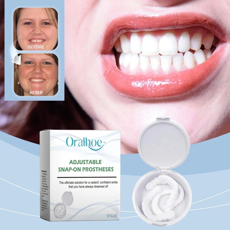 Adult Orthodontics Dentures Kit Correction Enhance Aesthetic Adjustable Snap On Teeth Gap Filling Modification Braces