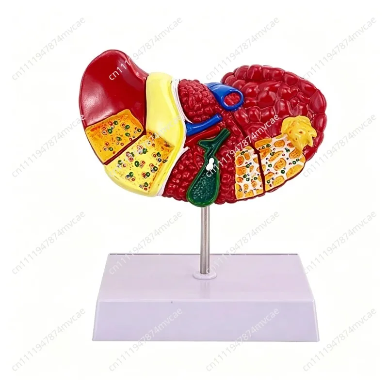 Suitable forLiver Model Pathological Liver Model For Common Pathologies, Human Anatomy  Office Anatomy Model