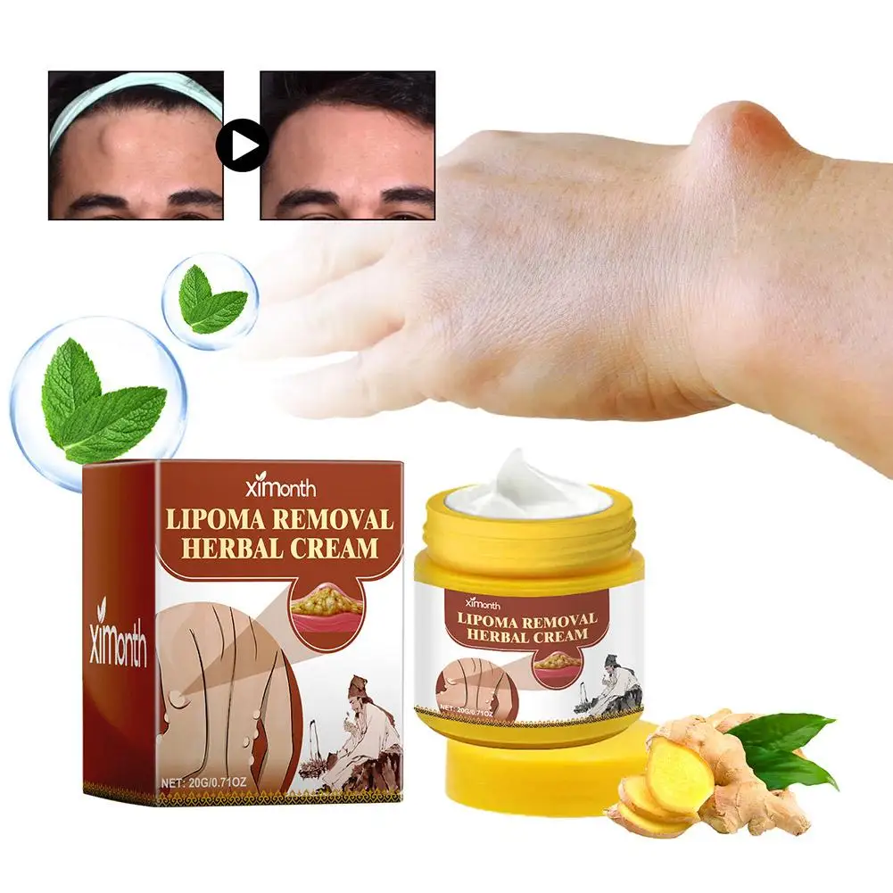 Creme Substituto Lipoma, Removedor de Caroço, Tratamento Celulite, Gesso Gordo, Inchaço da Pele, Fibroma, 20g