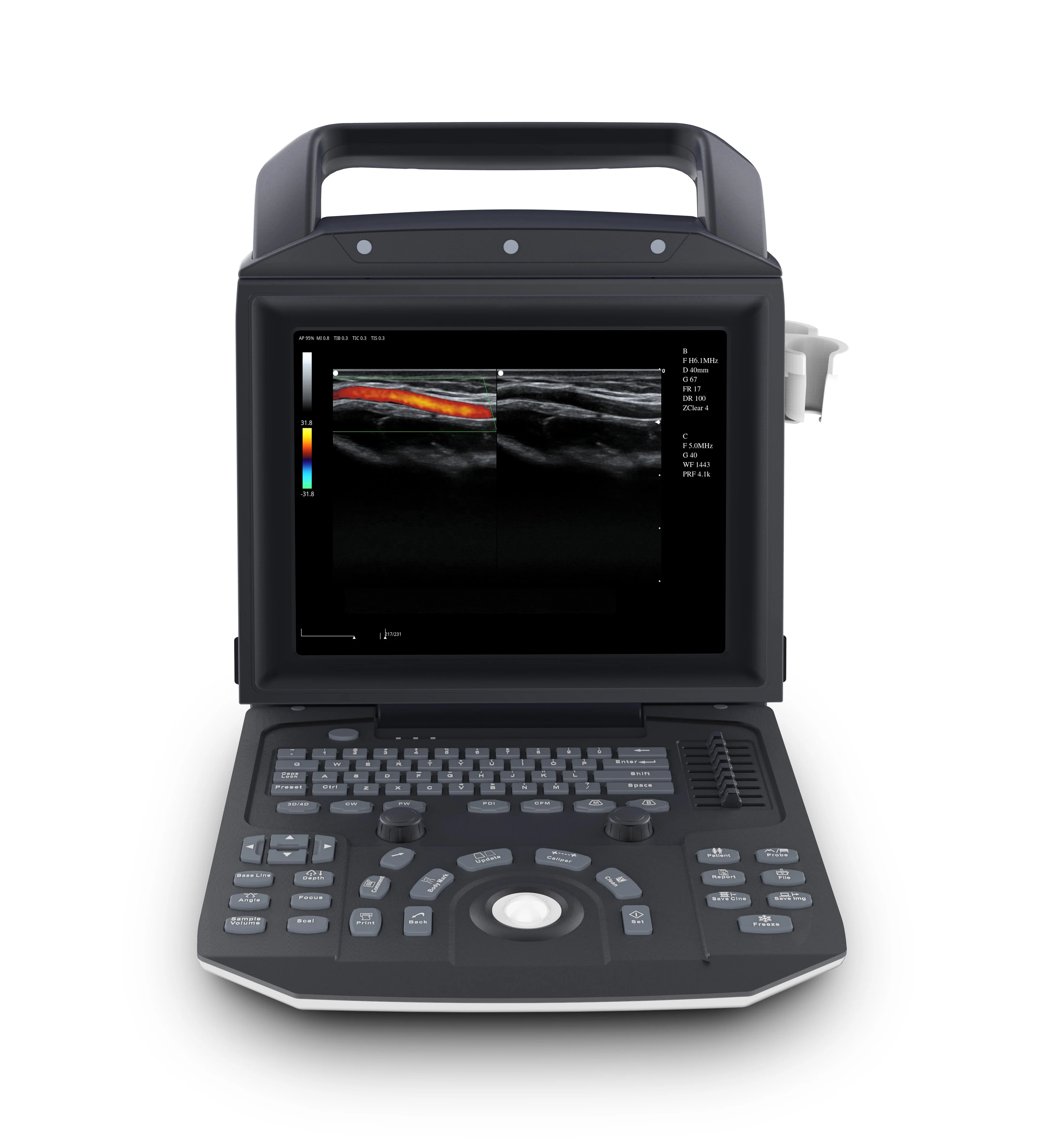 Zoncare ecografo 3d ecografo 4d color doppler ultrasound price color doppler ultrasound ultrasound machine color