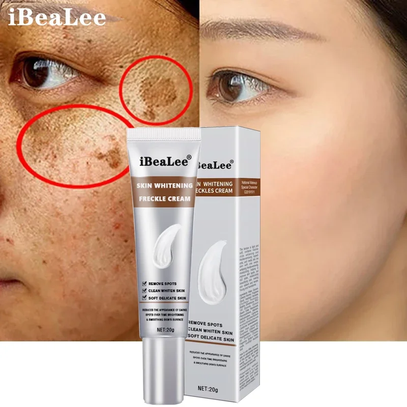 

Whitening Freckle Cream Remove Dark Spots Melasma Improve Pigmentation Whitening Smooth Moisturizing Repair Beauty Skin Products