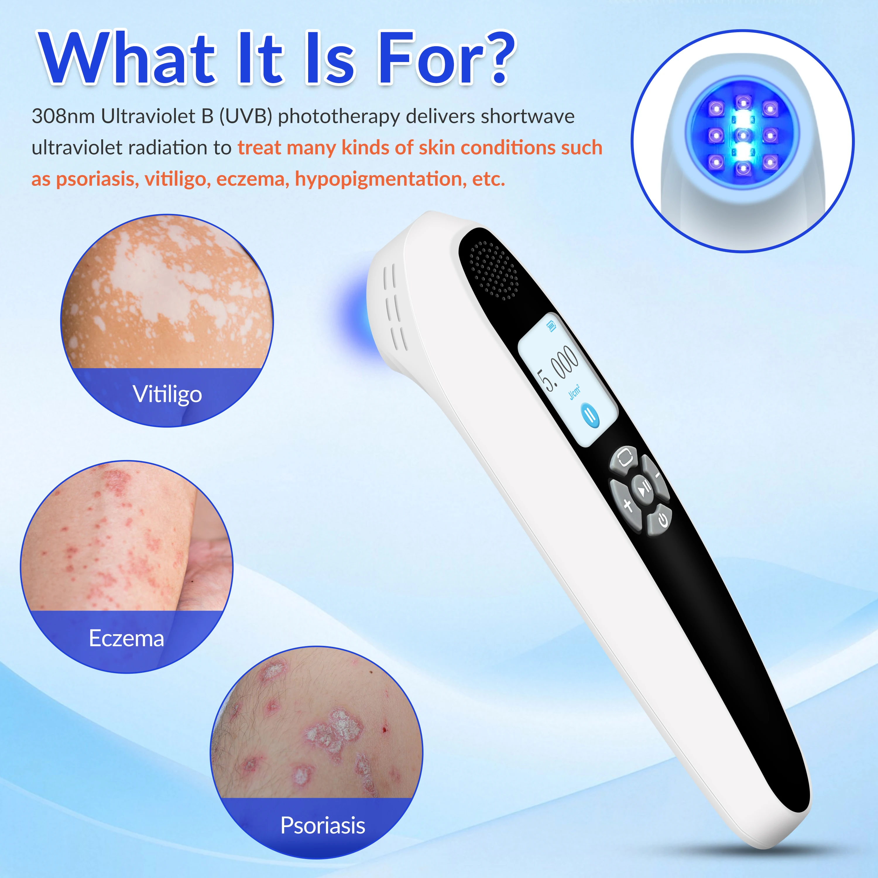 ZJZK 308nm UVB 광선 요법, 백반증 피부 재생, 건선, 습진 치료용 가정용 광선 요법, 좁은 UVB 광선 램프