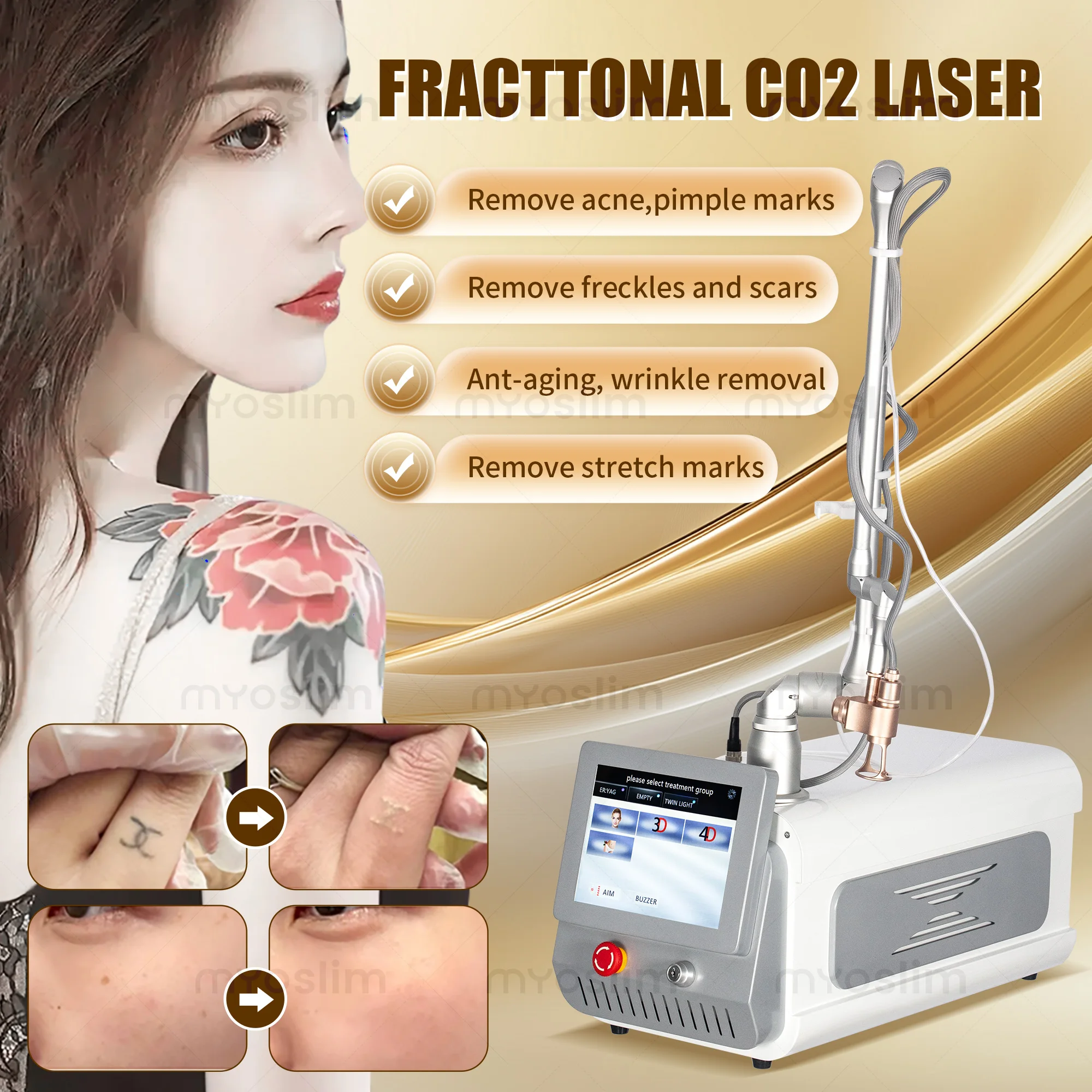 

Профессиональный CO2-обновленный радиочастотный электромагнитный косметический аппарат против старения, удаление морщин, омоложение кожи, лифтинг-машина для красоты лица