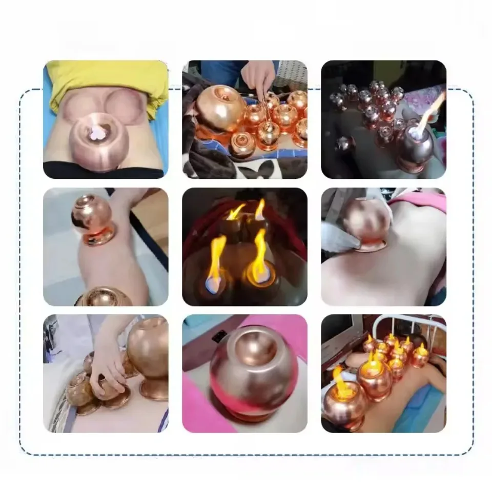 

Портативные чистые медные огненные банки всасывающего типа, массажные инструменты GuaSha, расслабляющая терапия для тела, большие вогнутые нижние нагревательные банки