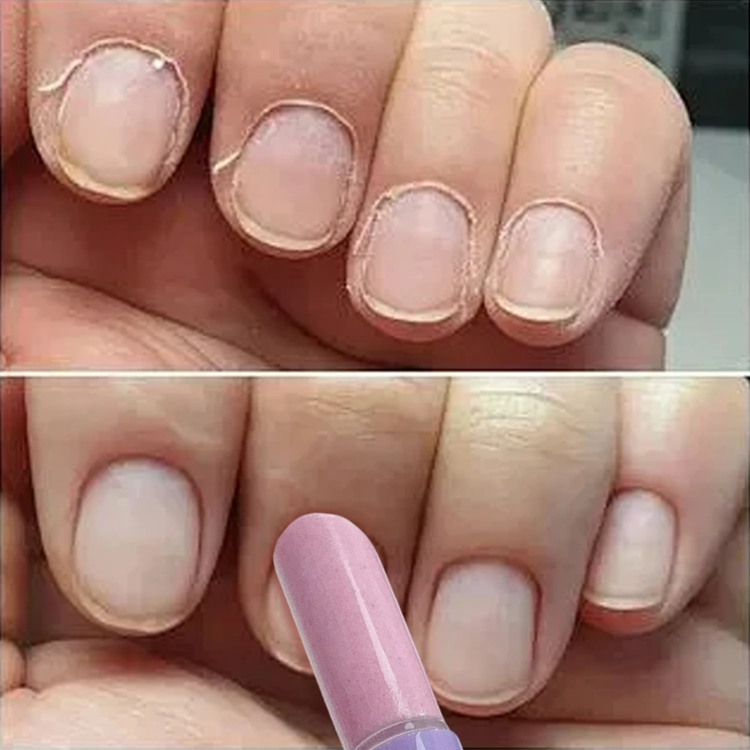3 في 1 قلم انتهازي زيت الأظافر يرطب الأظافر الجافة الضرر الأظافر الجلد الميت مزيل الجلد الميت القلم العناية بالأظافر مانيكير أداة #3